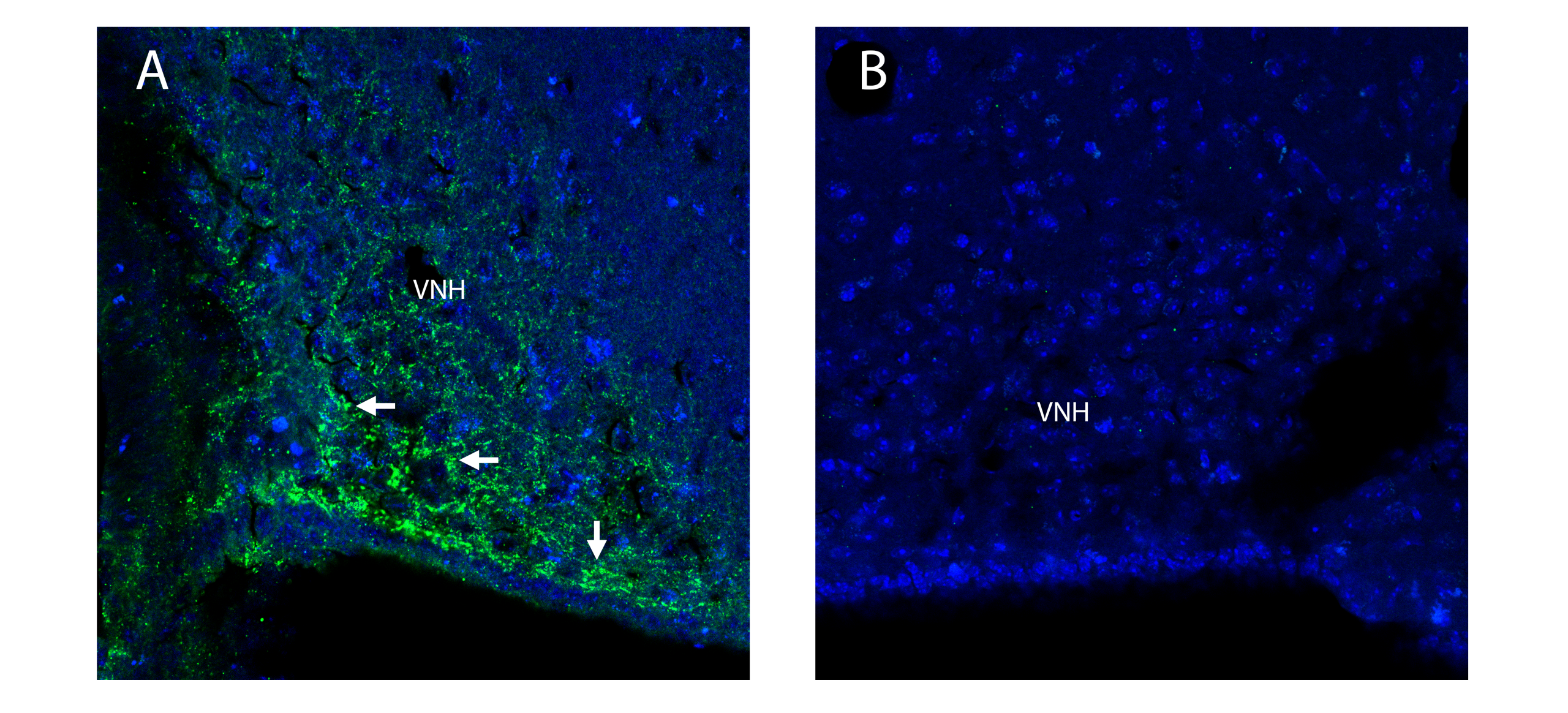 Adiponectin Receptor 1 Blocking Peptide