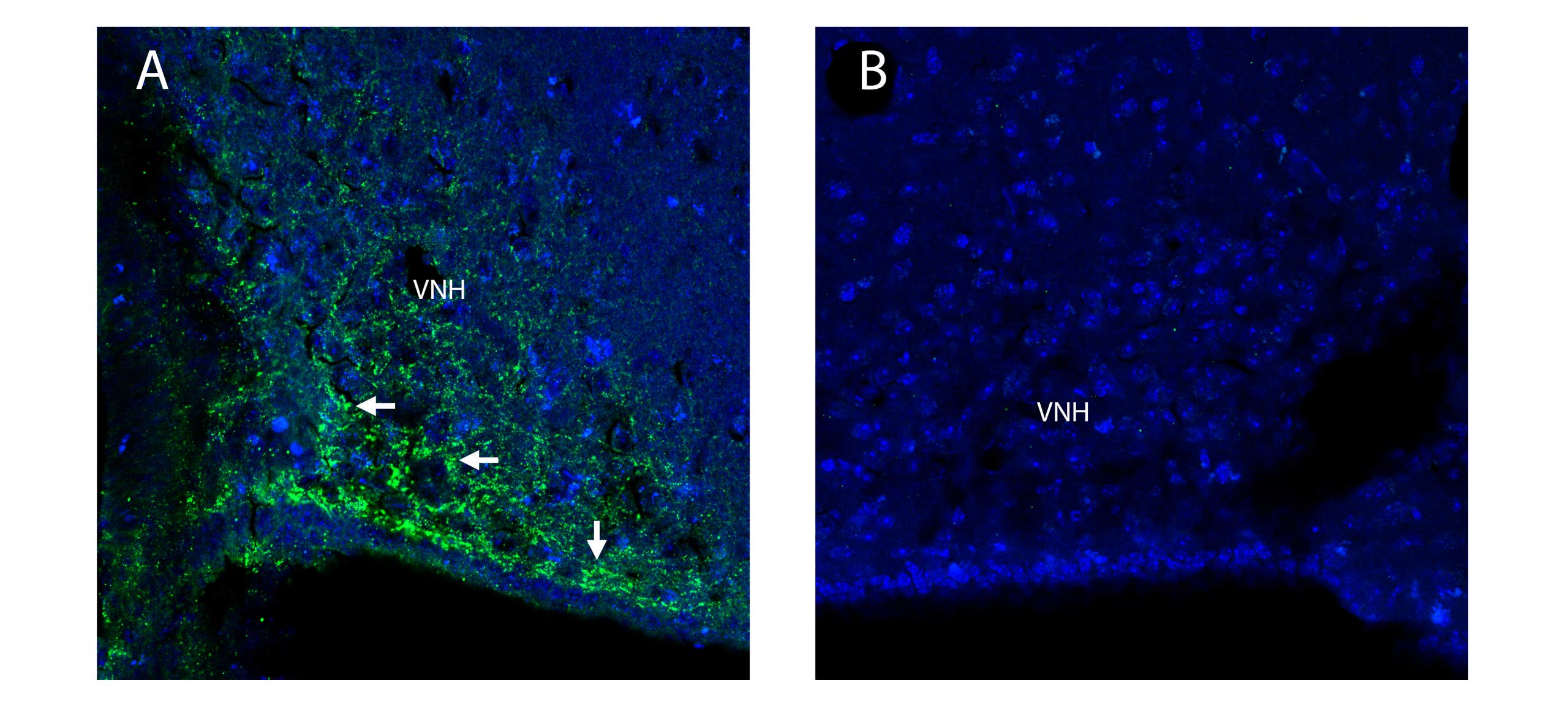Anti-Adiponectin Receptor 1 Antibody