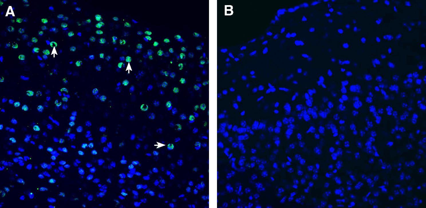 Anti-Neuronal Pentraxin 2 (NPTX2) Antibody