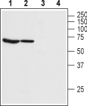 Bestrophin-1 (extracellular) Blocking Peptide
