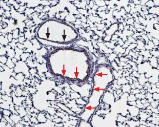 Anti-Bestrophin-1 (extracellular) Antibody