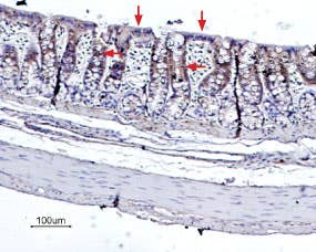 Anti-Bestrophin-2 (extracellular) Antibody