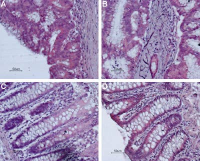Anti-Bombesin Receptor 2 (GRPR) (extracellular) Antibody