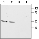 Bombesin Receptor 2/GRPR (extracellular) Blocking Peptide