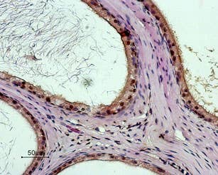 Anti-Bombesin Receptor 3 (extracellular) Antibody