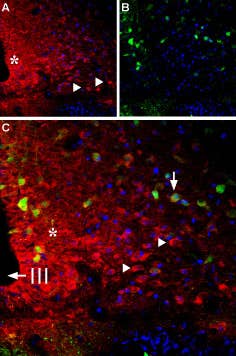 Anti-Bombesin Receptor 1 (NMBR) Antibody