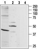 B1 Bradykinin Receptor/BDKRB1 Blocking Peptide