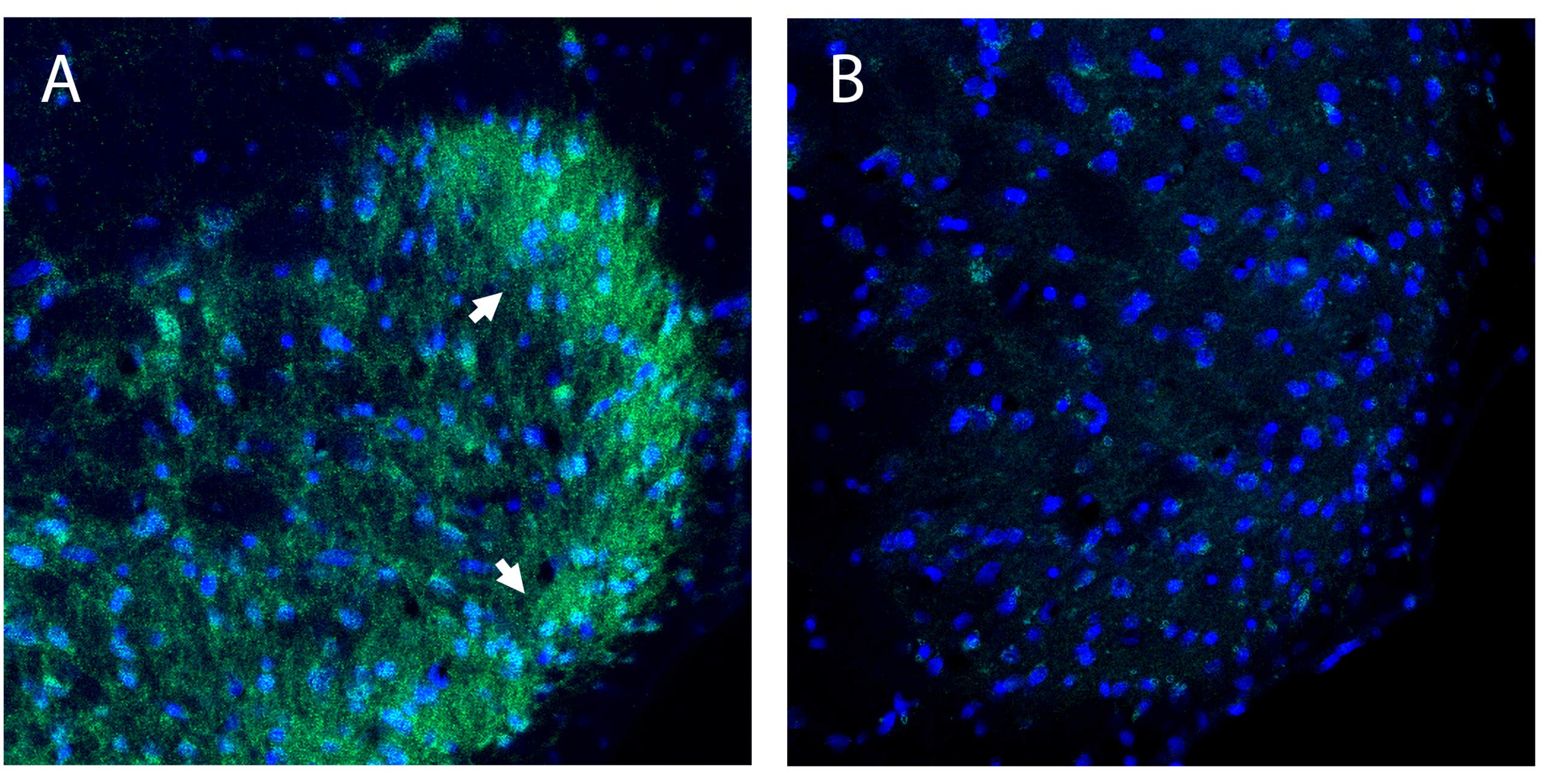 Anti-B1 Bradykinin Receptor (BDKRB1) (extracellular) Antibody