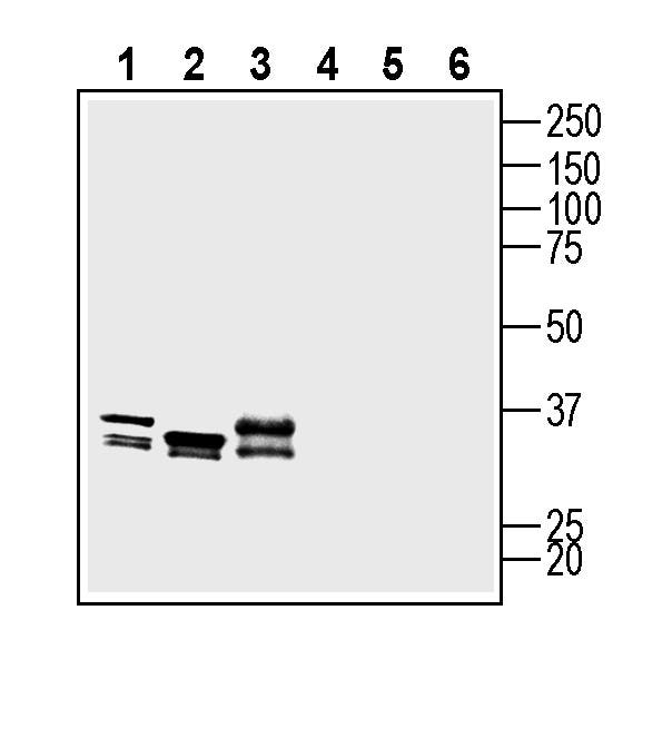 B1 Bradykinin Receptor (BDKRB1) (extracellular) Blocking Peptide