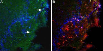 Anti-BAI1 (extracellular) Antibody