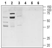 TGR5/GPBAR1 Blocking Peptide