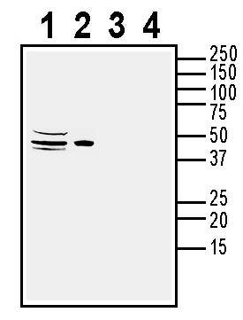 Anti-ACVRL1 (extracellular) Antibody