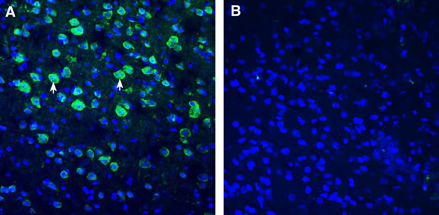 Anti-BMPR1A (extracellular) Antibody