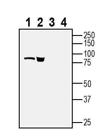 BMPR1A (extracellular) Blocking Peptide