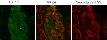 Anti-Ca<sub>V</sub>1.3 (CACNA1D) Antibody