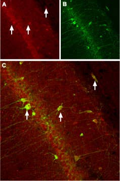 Anti-CACNB3 Antibody