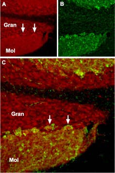 Anti-TRPC1 Antibody