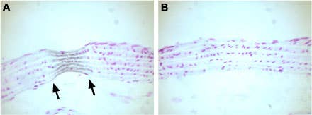 Anti-Ca<sub>V</sub>1.2a (CACNA1C) Antibody