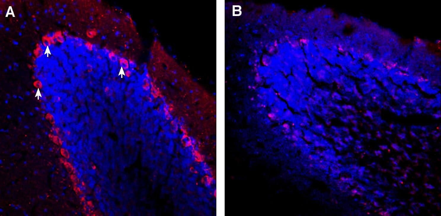 Guinea pig Anti-TRPC3 Antibody