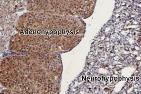 Anti-TRPC3 Antibody