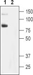 TRPC6 Blocking Peptide