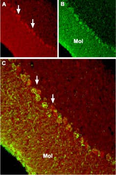 Anti-TRPC6 Antibody