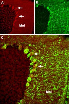 Anti-TRPC4 Antibody