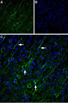 Anti-TRPC5 Antibody