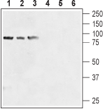 Anti-Human TRPV6 (extracellular) Antibody