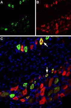 Anti-TRPV1 (VR1) (extracellular)-ATTO Fluor-488 Antibody