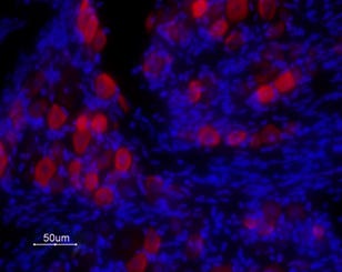 Anti-TRPV1 (VR1) (extracellular) Antibody