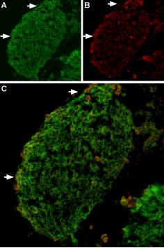Anti-TRPV2 (VRL1) Antibody