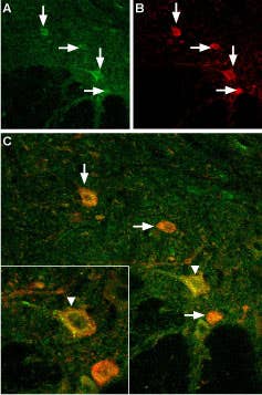 Anti-TRPV3 (extracellular) Antibody