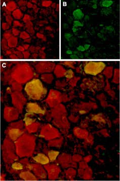 Anti-TRPV4 Antibody