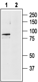 TRPV4 Blocking Peptide