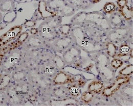 Anti-TRPV5 Antibody