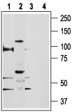 TRPV5 Blocking Peptide