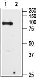 TRPV6 Blocking Peptide