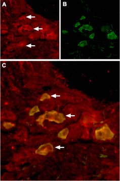 Anti-TRPV6 Antibody
