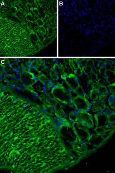 Anti-TRPA1 (extracellular) Antibody