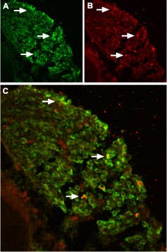 Anti-TRPV2 (VRL1) (extracellular) Antibody