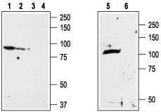 TRPV2/VRL1 (extracellular) Blocking Peptide