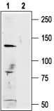 Anti-Human TRPM1 Antibody