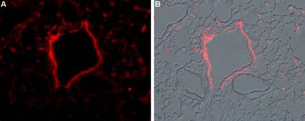 Anti-TRPM2-ATTO Fluor-594 Antibody