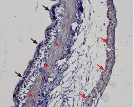 Anti-TRPM2 Antibody