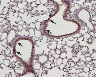 Anti-TRPM4 Antibody