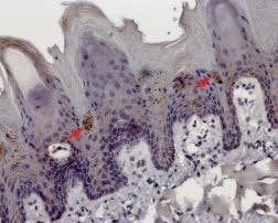 Anti-TRPM5 Antibody