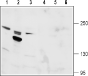 TRPM6 (extracellular) Blocking Peptide