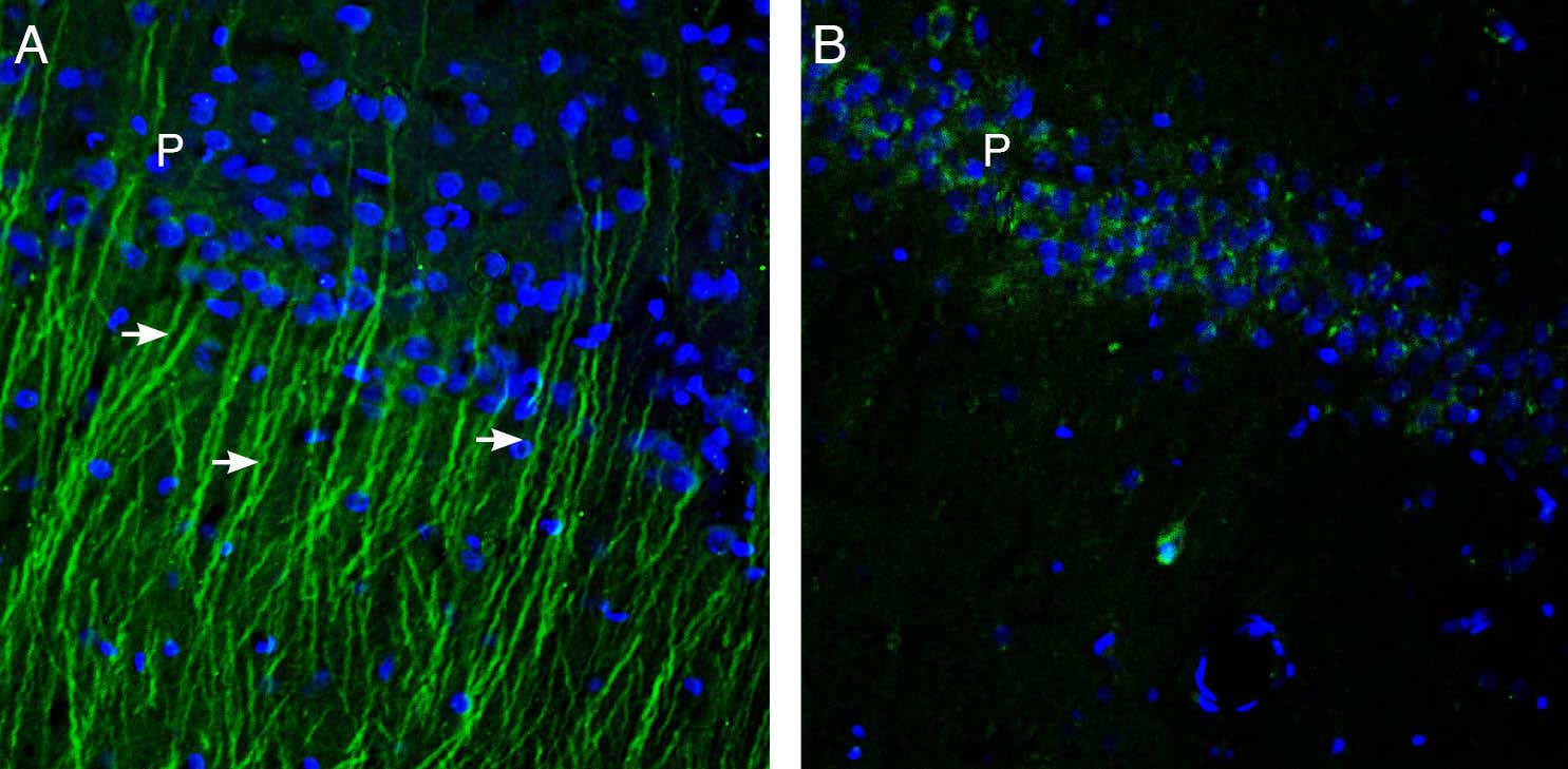 Anti-TRPM6 (extracellular) Antibody