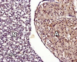 Anti-TRPM7 Antibody